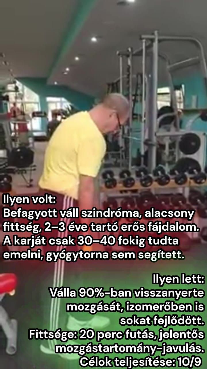 Kezdőkép: Befagyott váll 78 éves doktor úr