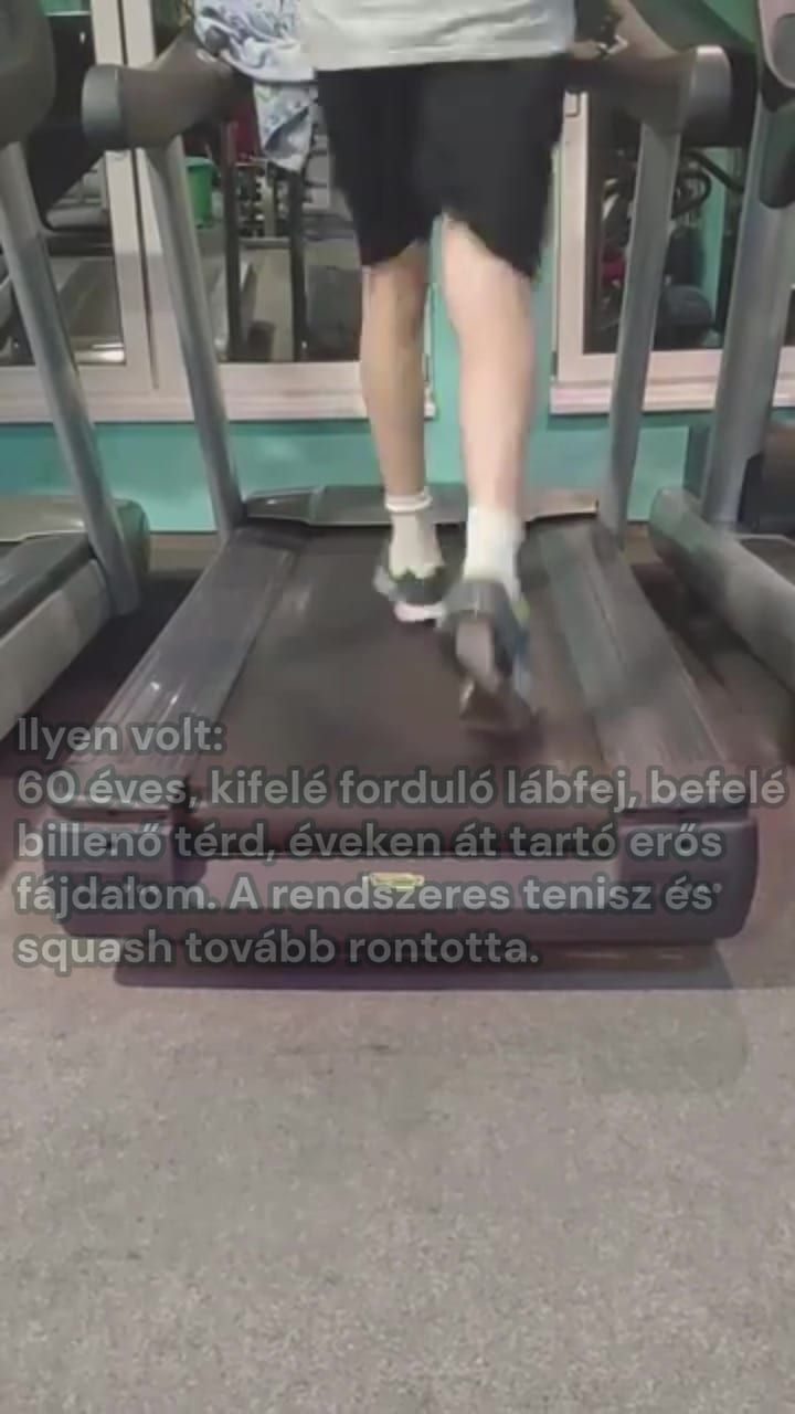 Kezdőkép: Térdfájás sikertörténet